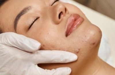 facial-treatment-for-acne-prone-skin-masseuse-in-2024-11-14-06-31-09-utc